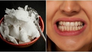 Photo of طرق طبيعية لتبييض الأسنان