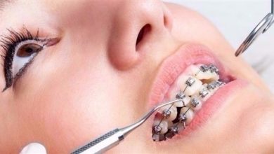 Photo of دراسة: تقويم الأسنان لا يضمن صحة الفم على المدى الطويل